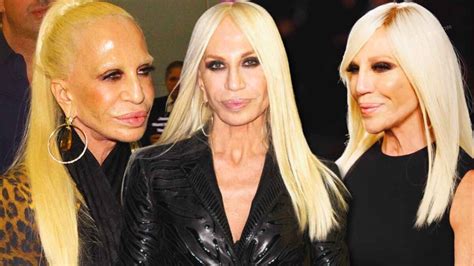 villa versace donatella|donatella versace face what happened.